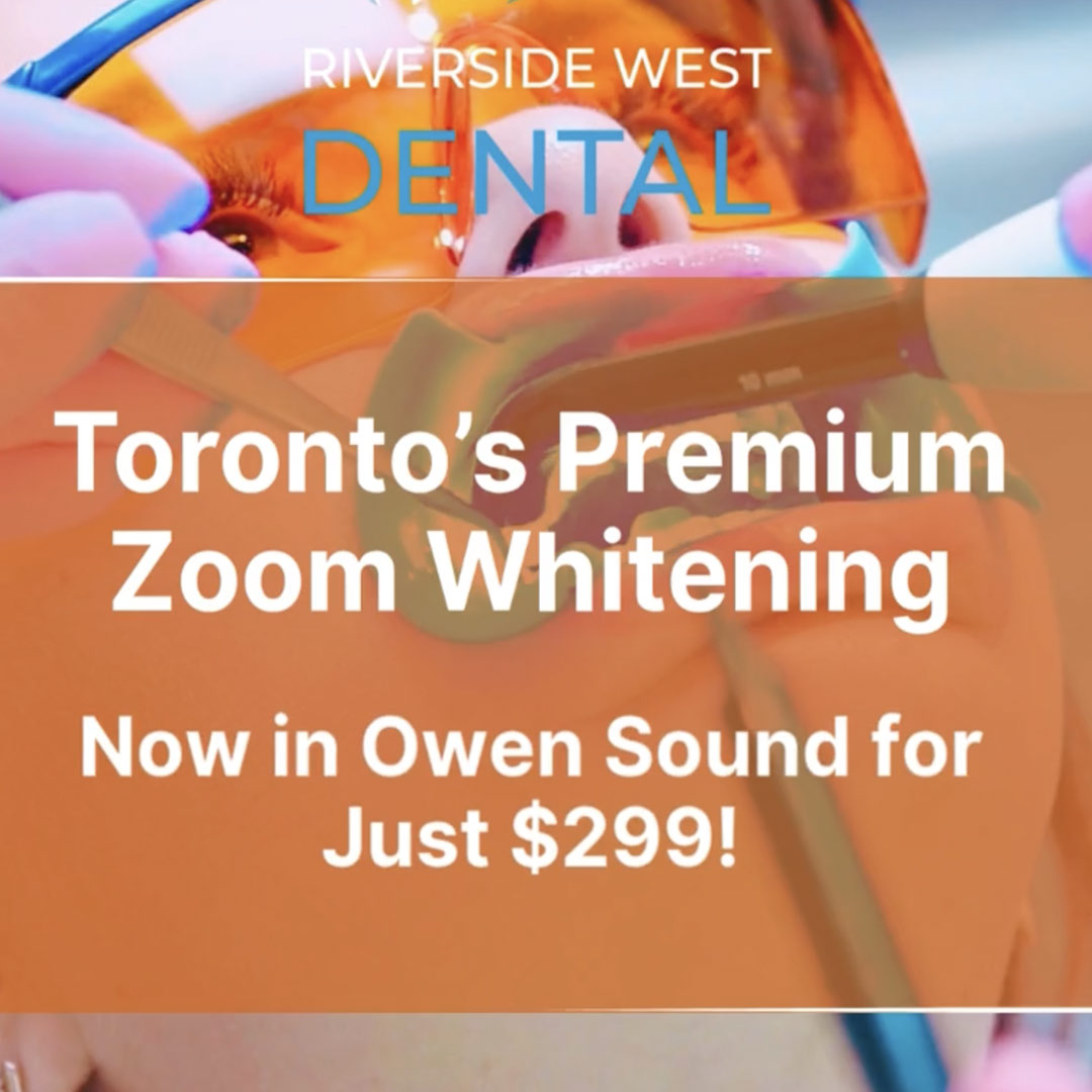 CAROSEL-2 ZOOM teeth whitening service