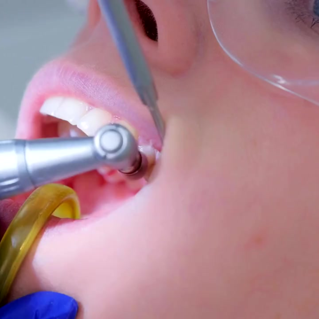 teethcleaning-static-image